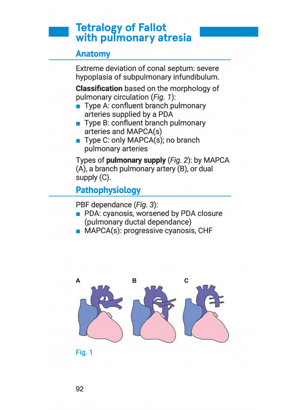 Pocketbook of congenital heart disease