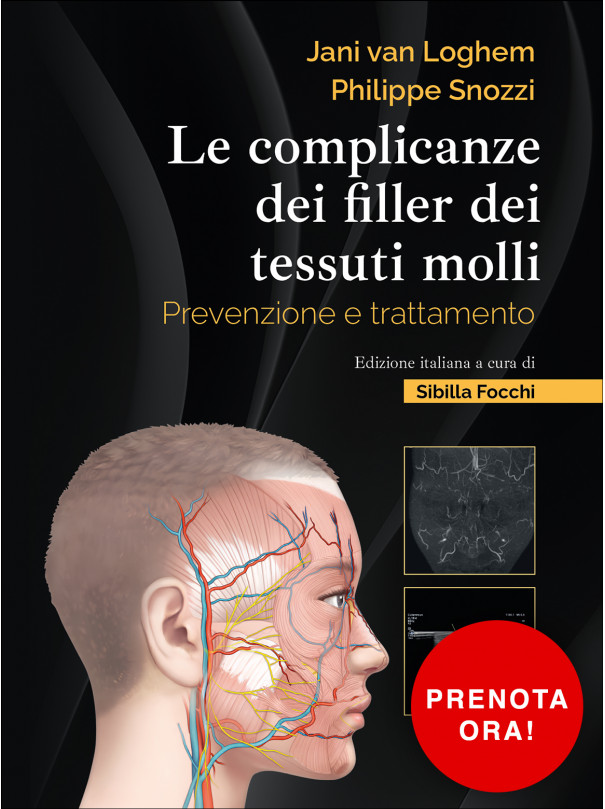 Le complicanze dei filler dei tessuti molli. Prevenzione e trattamento