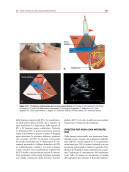 Ecografia Point-of-Care