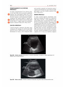 Ecografia Point-of-Care