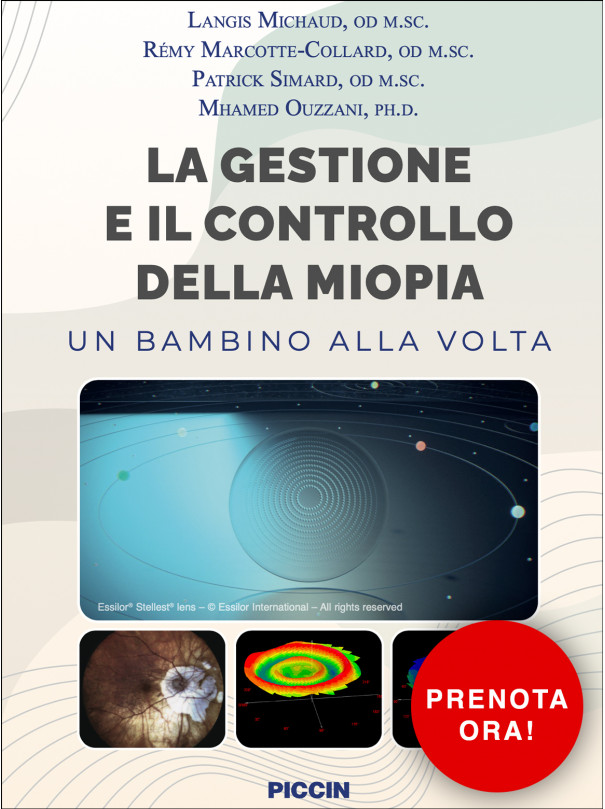 La gestione e il controllo della miopia