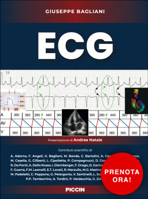 ECG